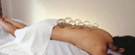 Cupping massage